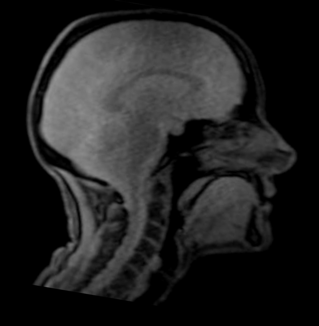 MRI still frame of the model-talker’s head