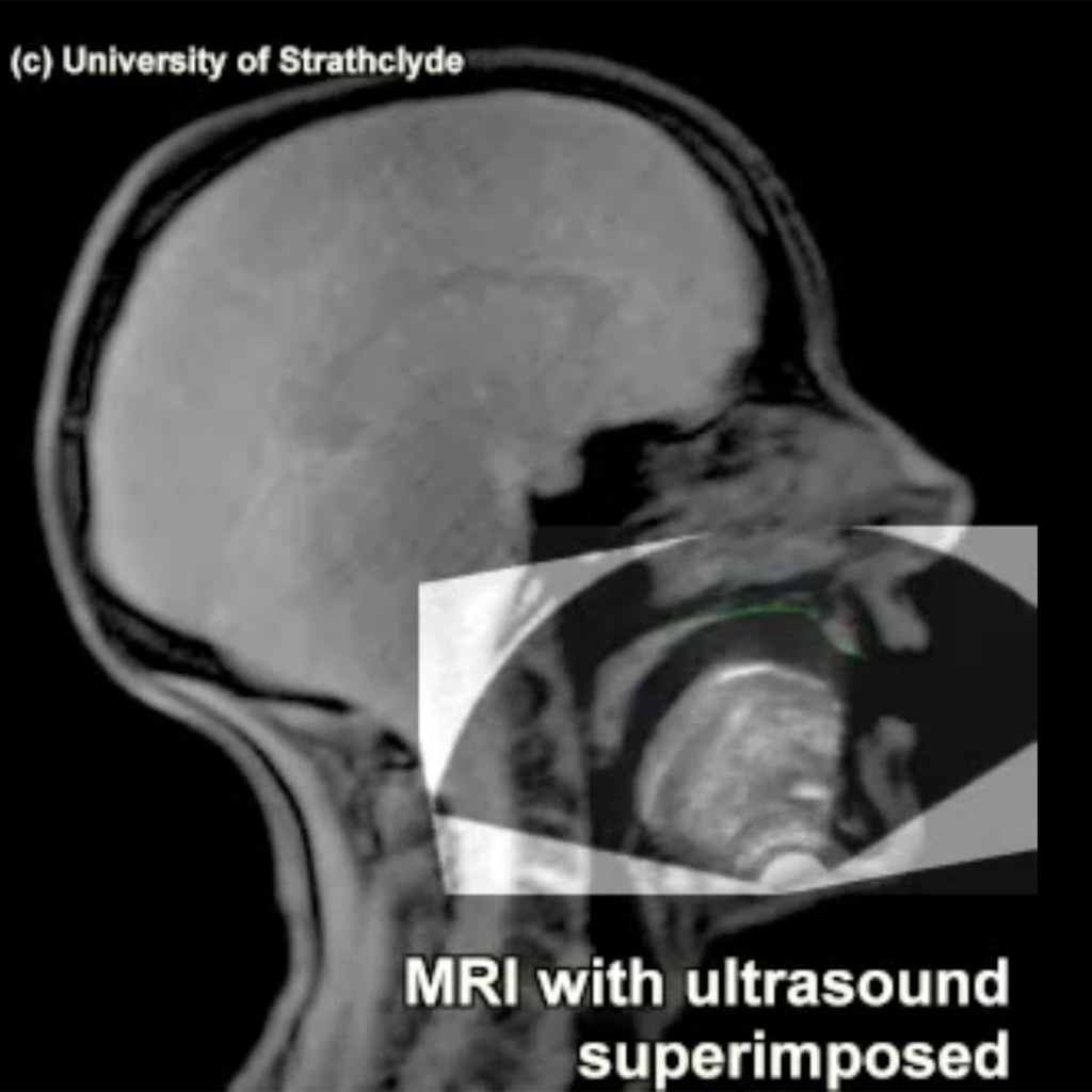 Comparing Ultrasound Tongue Imaging and Magnetic Resonance Imaging - dynamic