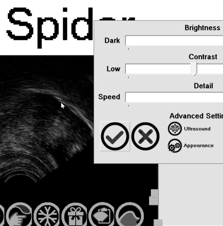 Adjusting ultrasound display settings for better tongue visibility